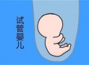 培养北京捐卵宝宝艺术细胞的小技巧